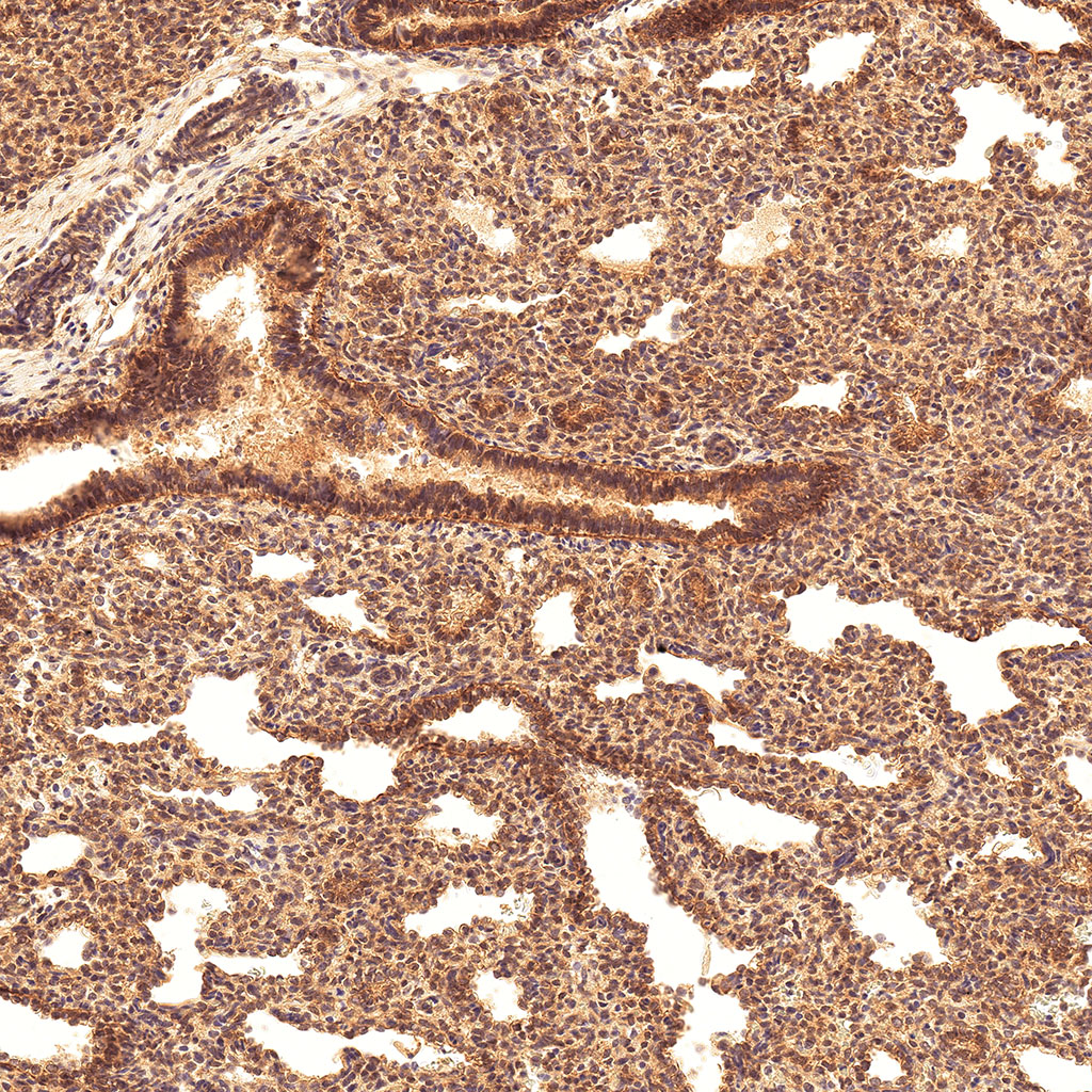 sars-cov-2 gene expression in a human fetus